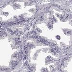 SPAG17 Polyclonal Antibody