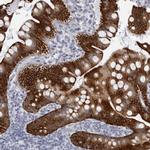 UROD Polyclonal Antibody