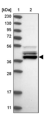 UROD Antibody in Western Blot (WB)