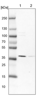 UROD Antibody in Western Blot (WB)