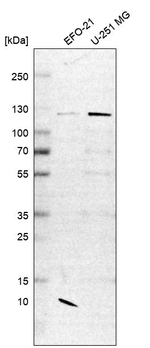CHD1L Antibody in Western Blot (WB)
