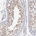 ESPN Polyclonal Antibody