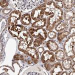 RSC1A1 Antibody in Immunohistochemistry (Paraffin) (IHC (P))