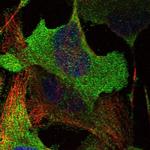 ADCK5 Antibody in Immunocytochemistry (ICC/IF)