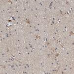 ADCK5 Antibody in Immunohistochemistry (Paraffin) (IHC (P))