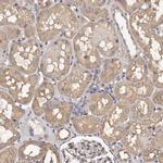 ADCK5 Antibody in Immunohistochemistry (Paraffin) (IHC (P))