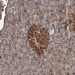 ADCK5 Antibody in Immunohistochemistry (Paraffin) (IHC (P))