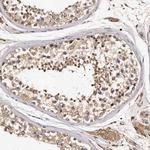 ADCK5 Antibody in Immunohistochemistry (Paraffin) (IHC (P))