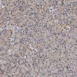 MTF1 Antibody in Immunohistochemistry (IHC)
