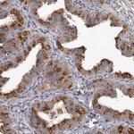 MTF1 Antibody in Immunohistochemistry (IHC)