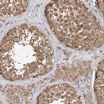 MTF1 Antibody in Immunohistochemistry (IHC)
