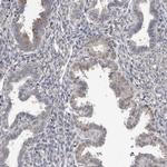MTF1 Antibody in Immunohistochemistry (IHC)