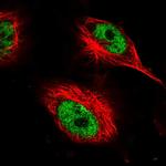 AHDC1 Polyclonal Antibody