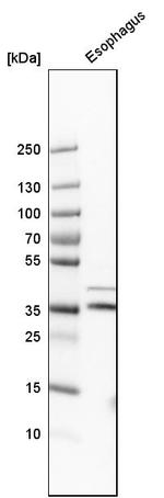 GPR157 Antibody in Western Blot (WB)