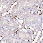 V-ATPase G3 Polyclonal Antibody