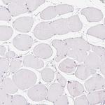 V-ATPase G3 Antibody in Immunohistochemistry (Paraffin) (IHC (P))