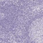 V-ATPase G3 Antibody in Immunohistochemistry (IHC)