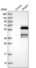 IPCEF1 Antibody in Western Blot (WB)
