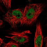 LRP5L Polyclonal Antibody