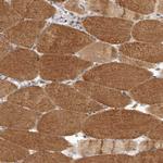 LRP5L Antibody in Immunohistochemistry (Paraffin) (IHC (P))