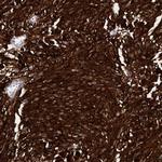 AUNIP Antibody in Immunohistochemistry (Paraffin) (IHC (P))