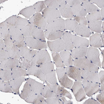 AUNIP Antibody in Immunohistochemistry (Paraffin) (IHC (P))