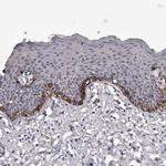 AUNIP Antibody in Immunohistochemistry (Paraffin) (IHC (P))