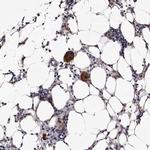 AUNIP Antibody in Immunohistochemistry (Paraffin) (IHC (P))
