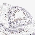 AUNIP Antibody in Immunohistochemistry (Paraffin) (IHC (P))
