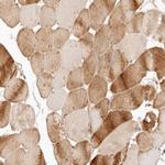 PPP1R3B Polyclonal Antibody