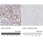 LAD1 Antibody in Immunohistochemistry (IHC)