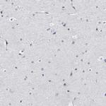 LAD1 Antibody in Immunohistochemistry (IHC)
