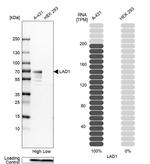 LAD1 Antibody in Western Blot (WB)