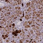 FAM117B Antibody in Immunohistochemistry (Paraffin) (IHC (P))