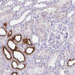 SLC12A3 Antibody in Immunohistochemistry (Paraffin) (IHC (P))