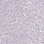 SLC12A3 Antibody in Immunohistochemistry (Paraffin) (IHC (P))