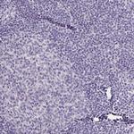 SLC12A3 Antibody in Immunohistochemistry (IHC)