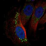 GARNL3 Polyclonal Antibody