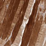 TOR3A Antibody in Immunohistochemistry (Paraffin) (IHC (P))