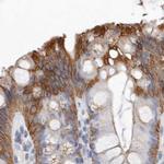 MRPL18 Antibody in Immunohistochemistry (IHC)
