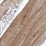 P2X6 Antibody in Immunohistochemistry (Paraffin) (IHC (P))