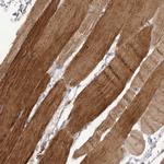 P2X6 Polyclonal Antibody