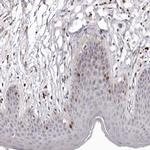 CDCA8 Polyclonal Antibody