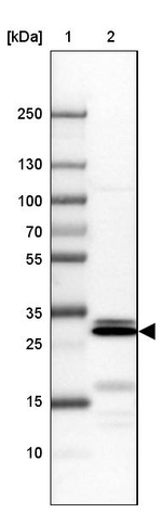 CDCA8 Antibody in Western Blot (WB)