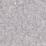 LCORL Antibody in Immunohistochemistry (Paraffin) (IHC (P))