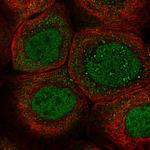 ZNF260 Polyclonal Antibody