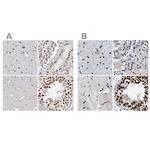 SFRS15 Antibody in Immunohistochemistry (IHC)