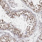 SFRS15 Antibody in Immunohistochemistry (IHC)