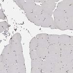 SFRS15 Antibody in Immunohistochemistry (IHC)