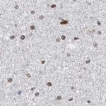 SFRS15 Antibody in Immunohistochemistry (IHC)